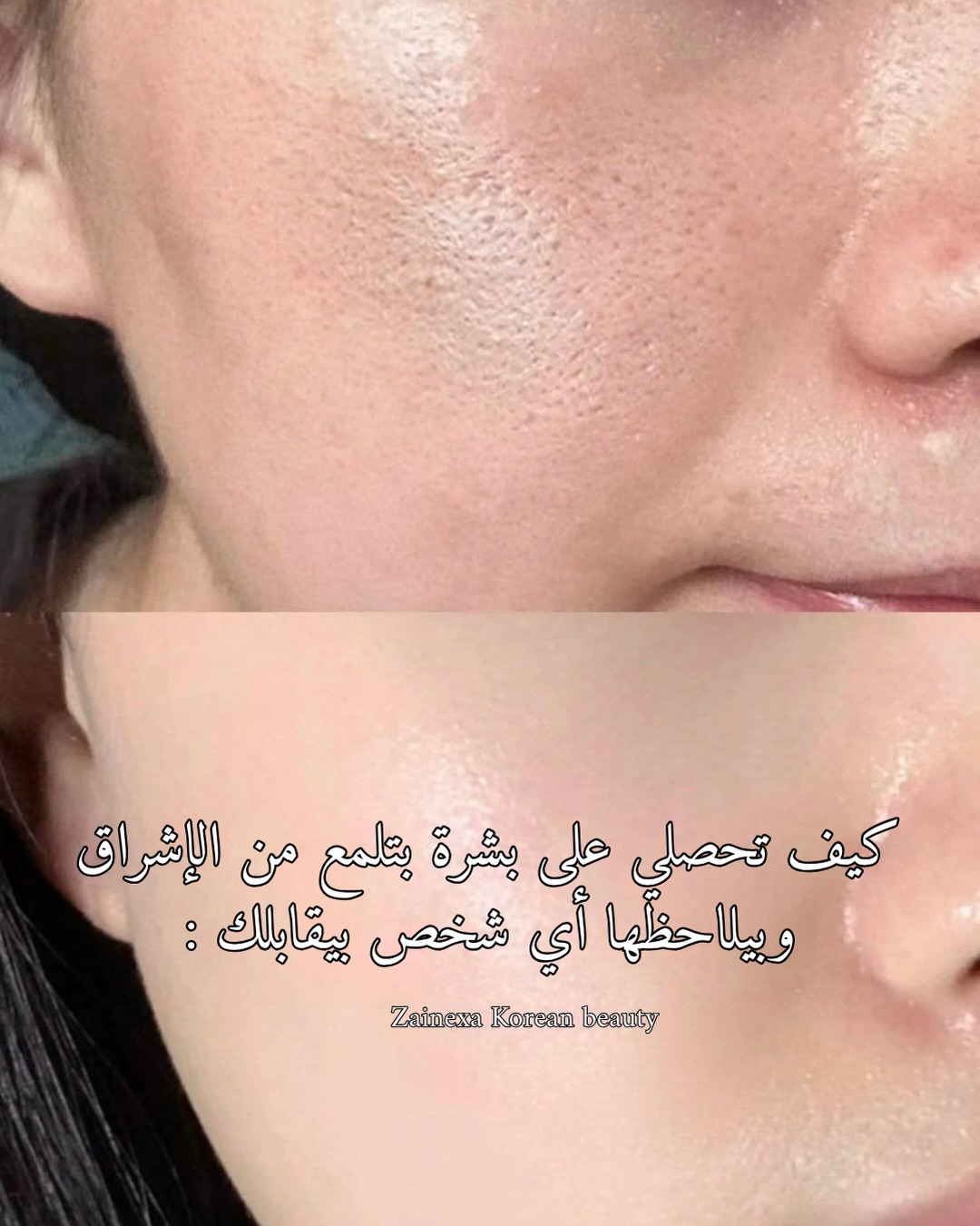 Zainexa before-and-after glass skin educational post in Arabic